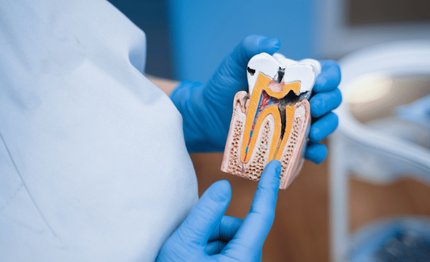 Odontologie - Tratament Carii Oradea