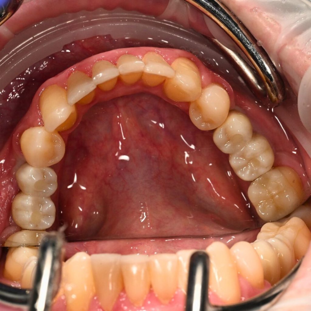 Implantologie Dentară Oradea
